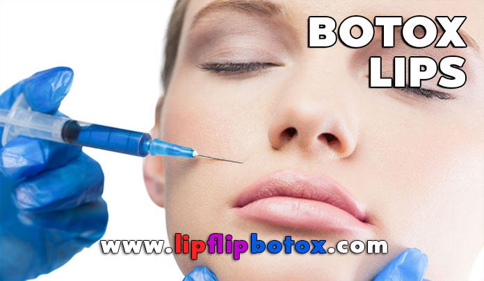 botox-lips