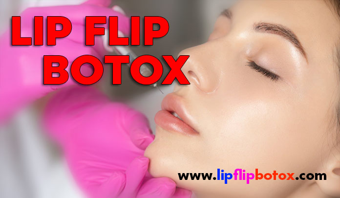lip flip botox