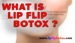 what is lipflip botox
