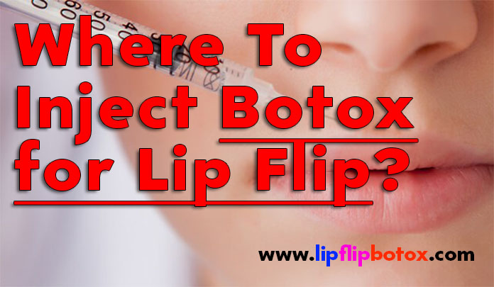 where-to-inject-botox-for-lip-flip